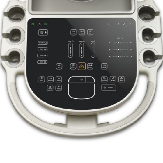 Ультразвуковая система Philips Sparq